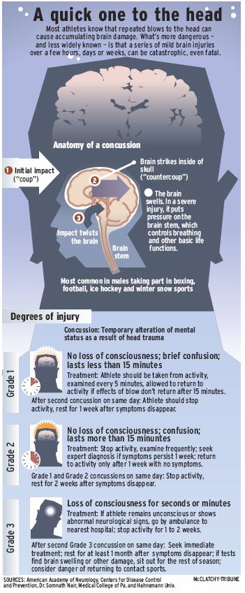 Concussion Information